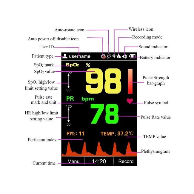 Handheld Pulse Oximeter SP-20 – Fingertip Blood Oxygen (SpO₂) & Heart Rate Monitor with OLED Display, Portable, Accurate, Fast Reading for Home, Clinic & Sports