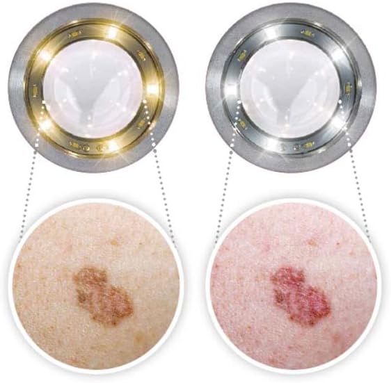 LUXAMED LuxaScope Dermatoscope CCT LED 2.5V - Durable, Build with Contact Plate, Bright LED, Light Ergonomic, Comfortable Design - Portable and Reliable Tool for Clear Detailed Visual Tasks