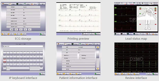 Comen CM1200A / CM1200B 12-Channel ECG Machine – 8.4" Color Touch Screen Interpretive Electrocardiograph with Internal Storage & Built-in Printer