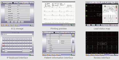 Comen CM1200A / CM1200B 12-Channel ECG Machine – 8.4" Color Touch Screen Interpretive Electrocardiograph with Internal Storage & Built-in Printer