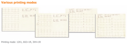 Comen CM1200A / CM1200B 12-Channel ECG Machine – 8.4" Color Touch Screen Interpretive Electrocardiograph with Internal Storage & Built-in Printer